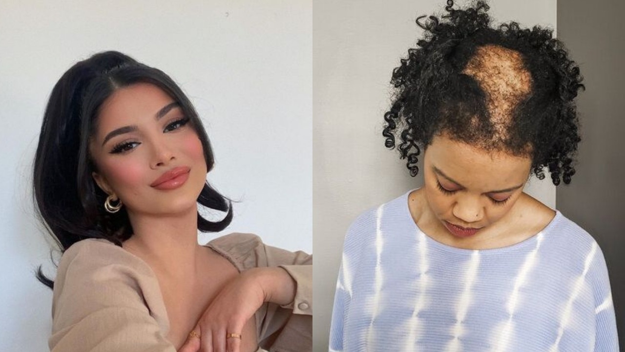 habitos que pueden causarte alopecia