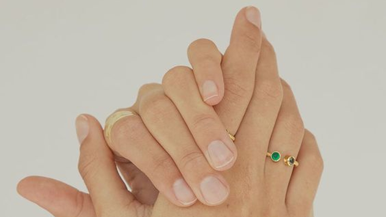 que anillos manchan dedos