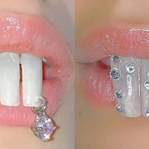 Dientes de ardilla la nueva tendencia de belleza