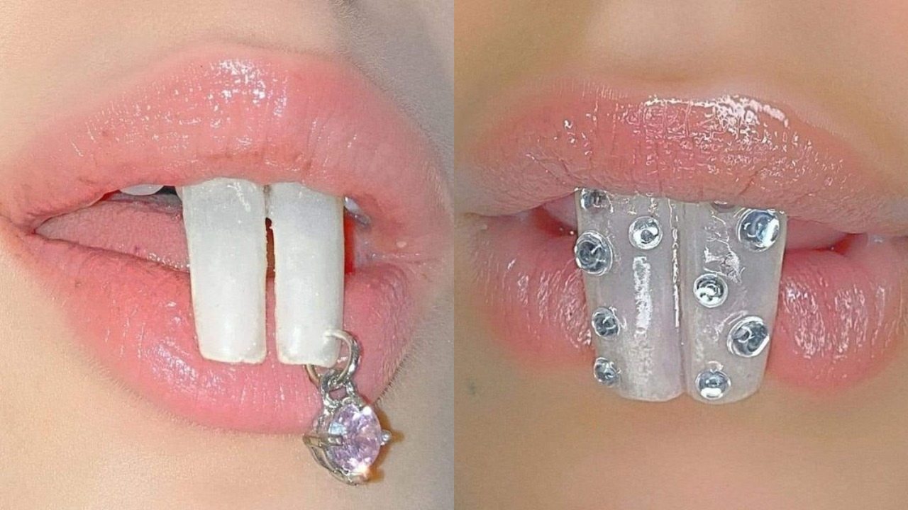 Dientes de ardilla la nueva tendencia de belleza