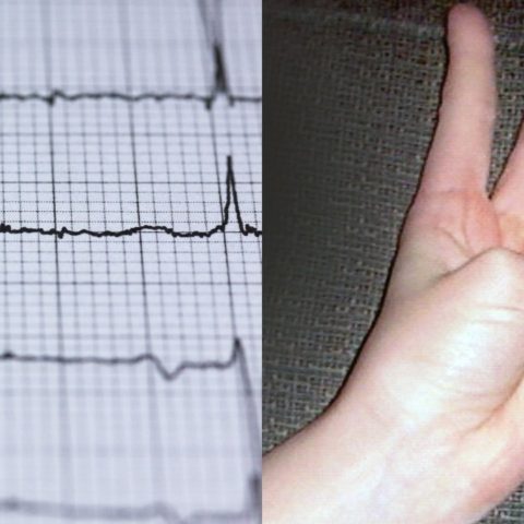 movimiento para saber si tienes problema cardiovascular