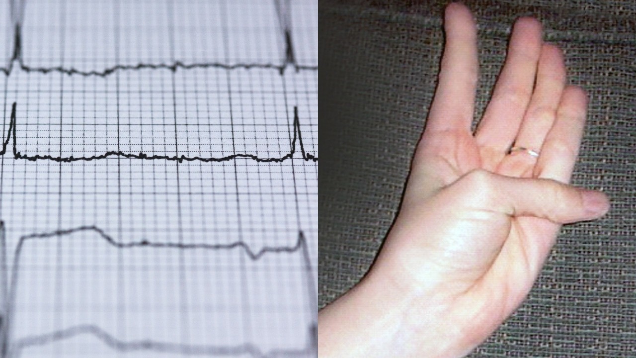movimiento para saber si tienes problema cardiovascular