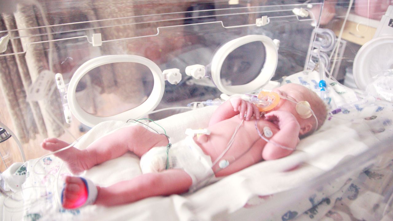 Parto-prematuro-consecuencias-bebe 