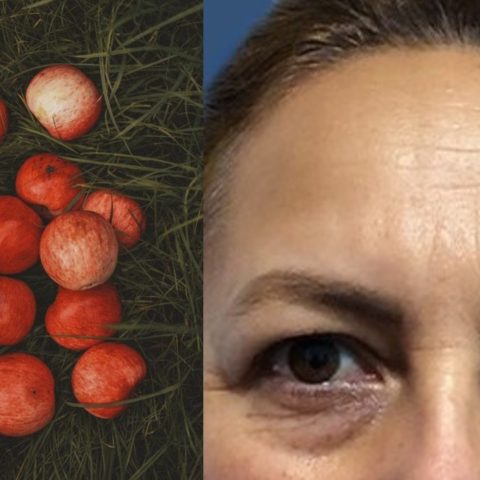 combatir los párpados caídos