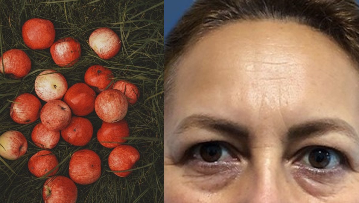 combatir los párpados caídos