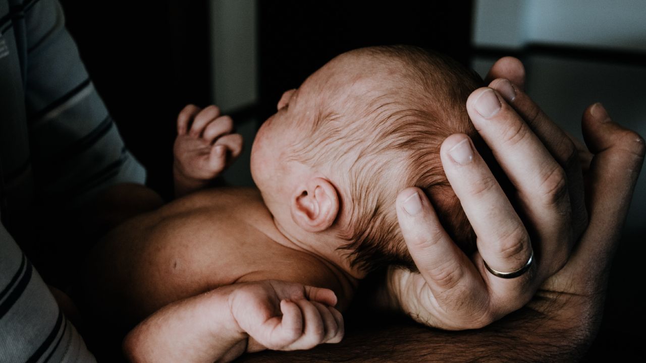 Mollera sumida en bebés, causas y posibles riesgos