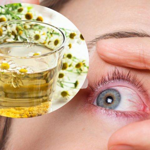 Por qué no deberías usar manzanilla en los ojos