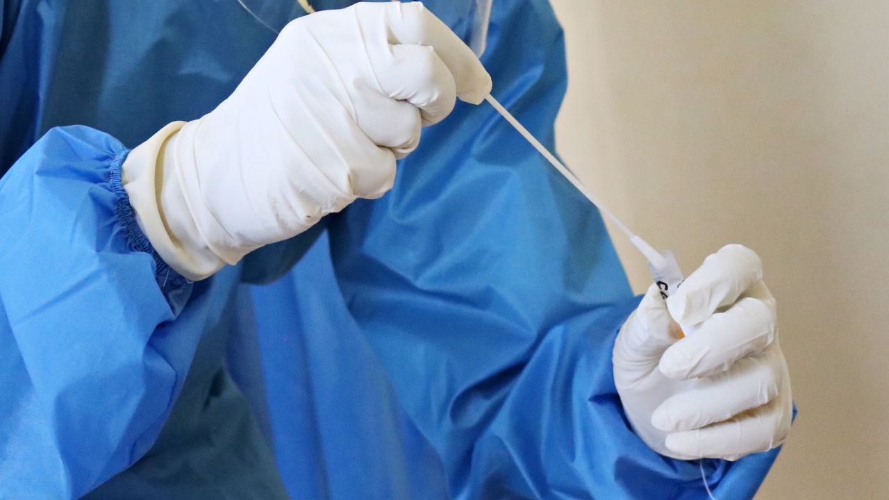 covid-19 de qué variante me contagié