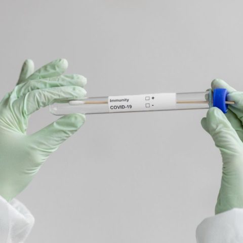 Covid-19 de qué variante me contagié