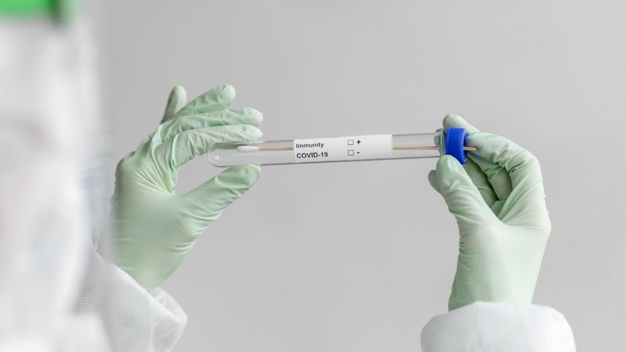 Covid-19 de qué variante me contagié