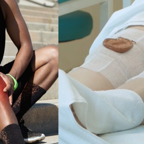 Cataplasmas para aliviar el dolor