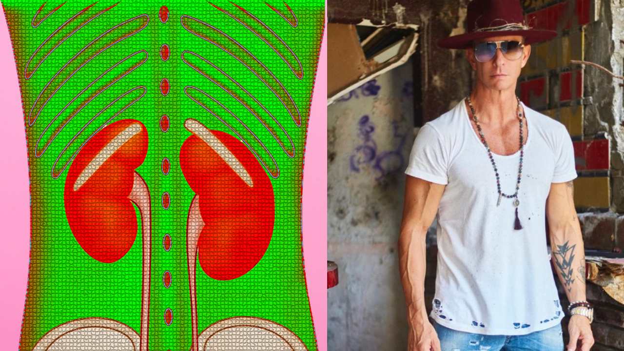 que es la agenesia renal