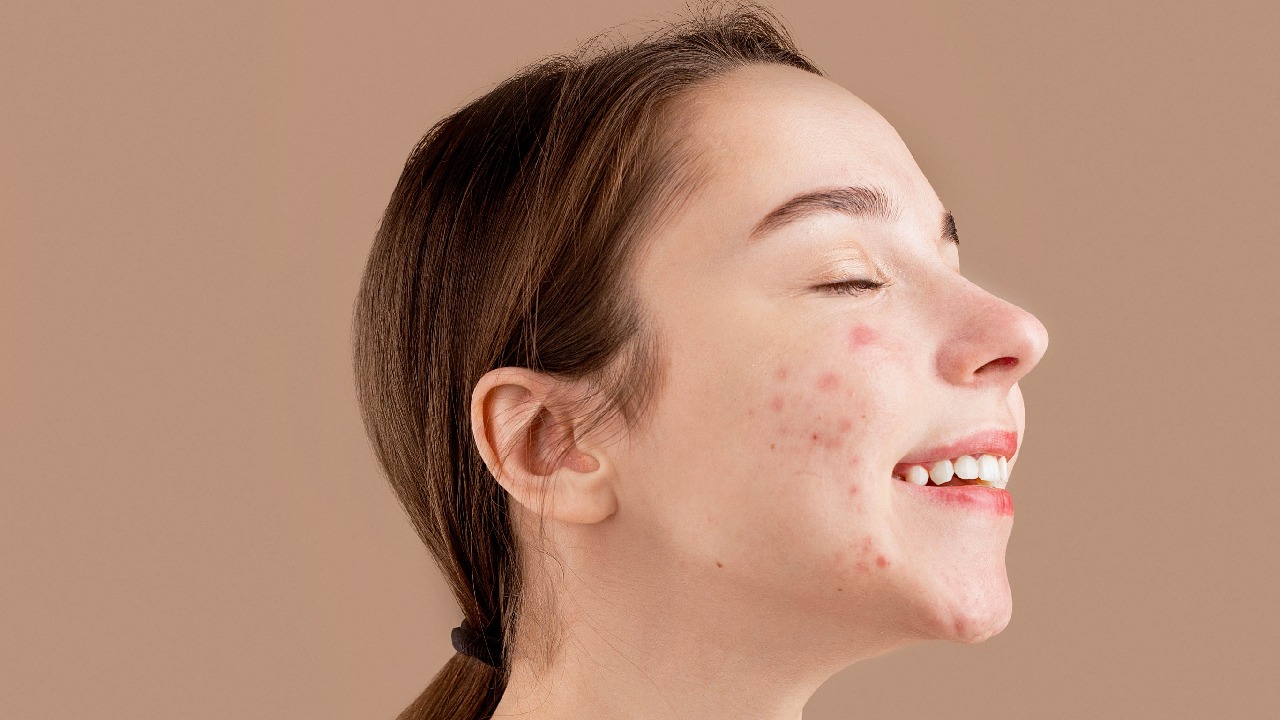 origen emocional de enfermedades de piel