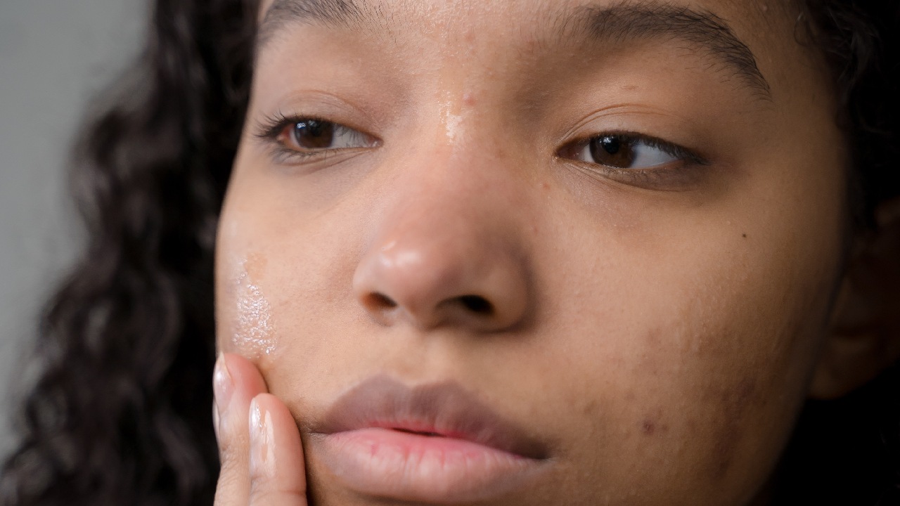 enfermedades de piel con causas emocionales