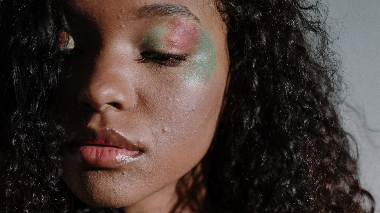 origen emocional de acne