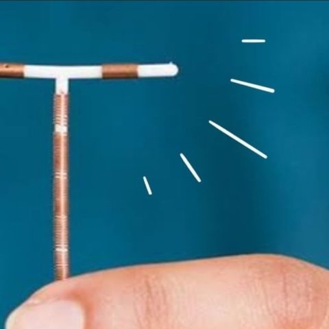 Diferencias entre el DIU