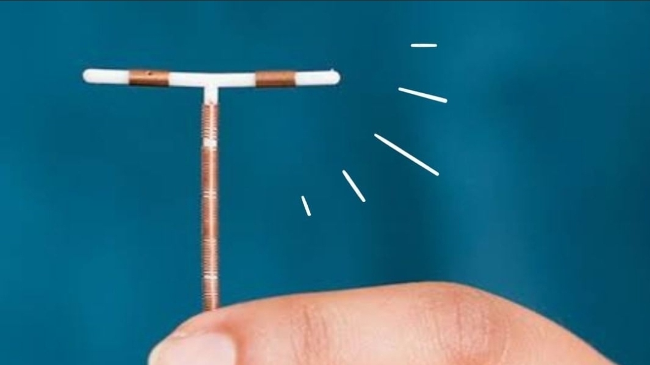 Diferencias entre el DIU