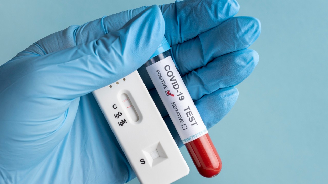 Errores que cometes cuando te haces una prueba de PCR