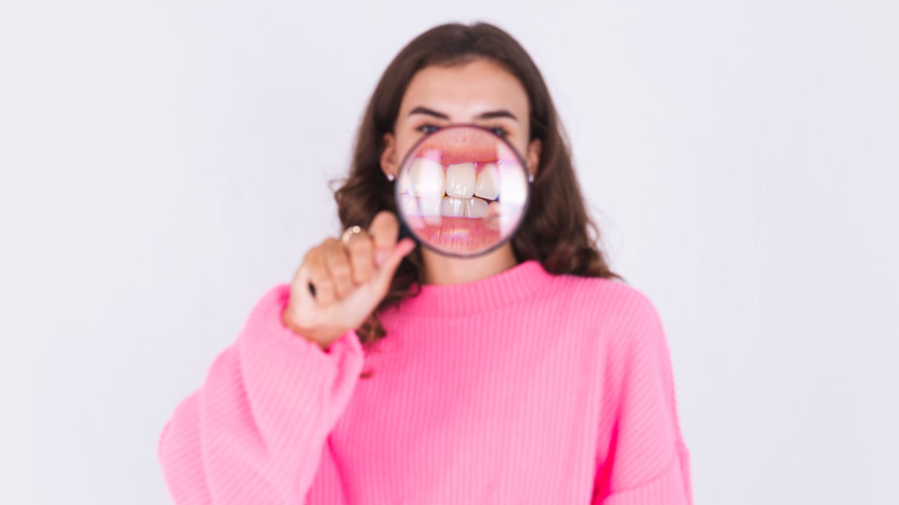 Manchas blancas en los dientes