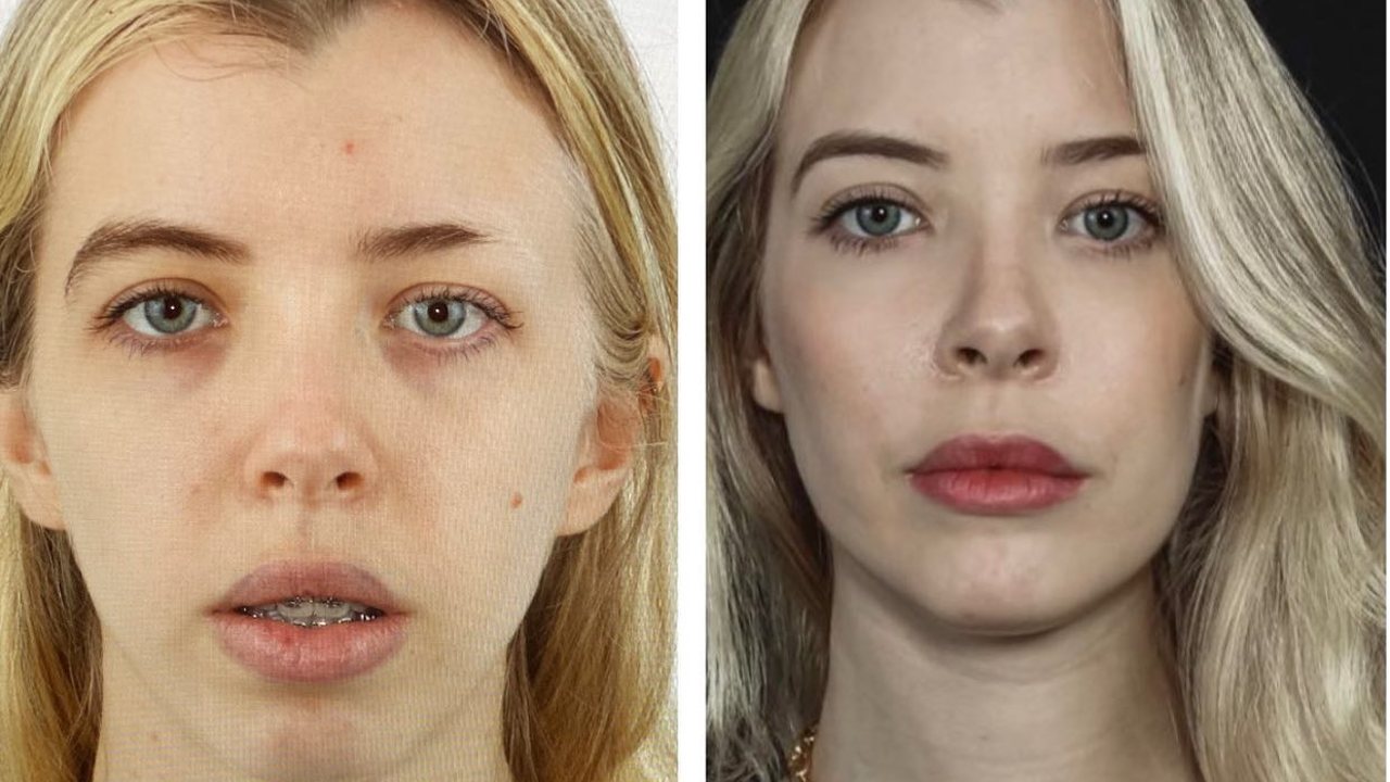 qué pasa cuando Respiras por la boca