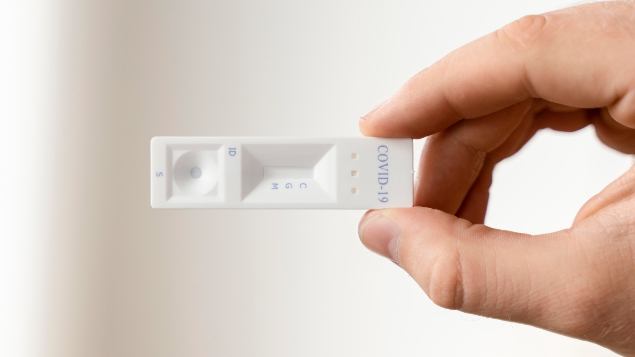 prueba de antigenos covid