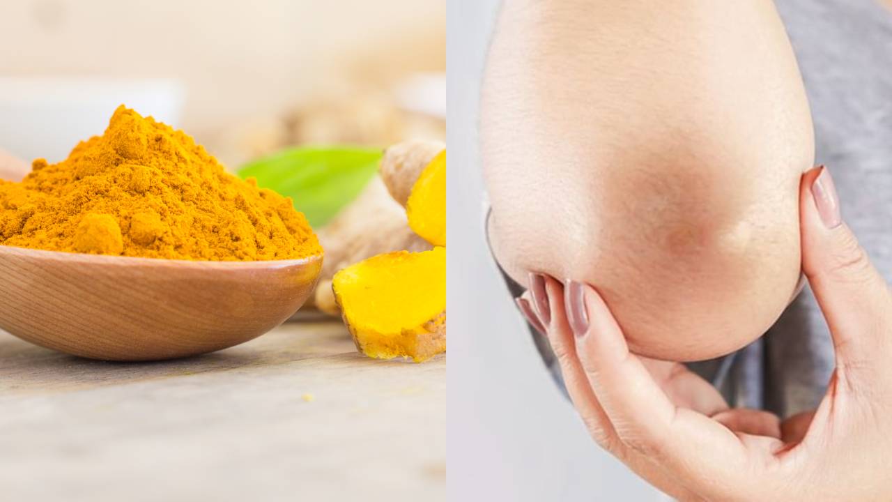 aclarar codos y rodillas con cúrcuma