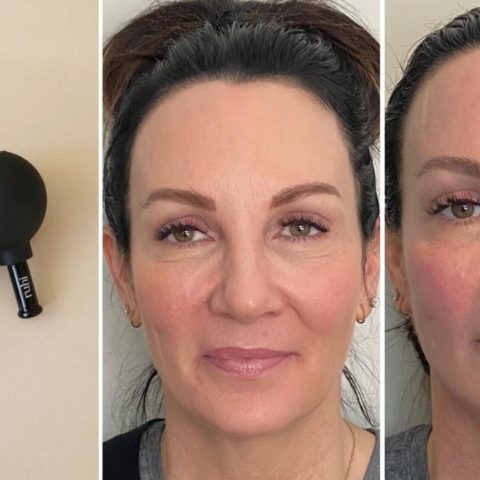 que es cupping facial