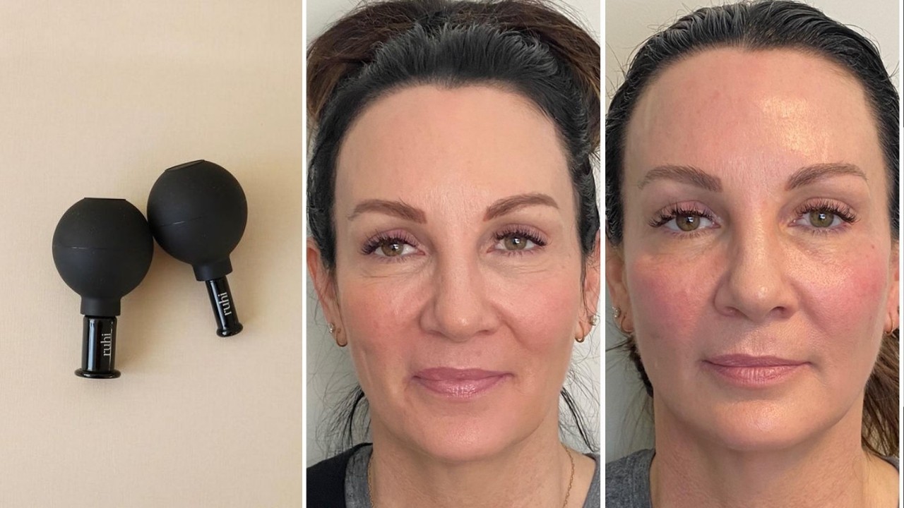 que es cupping facial