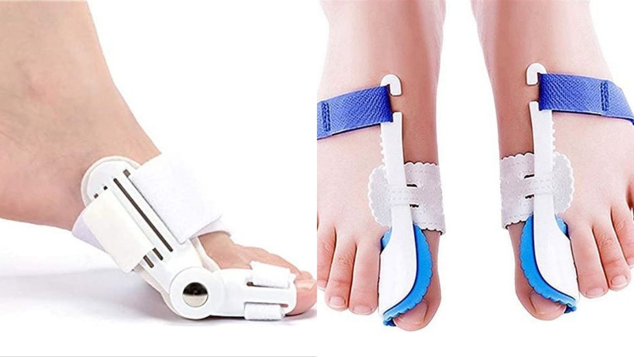 se pueden corregir juanetes sin cirugia