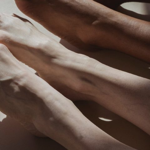 como se tratan juanetes