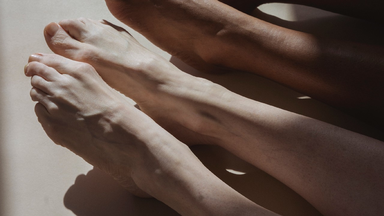 como se tratan juanetes