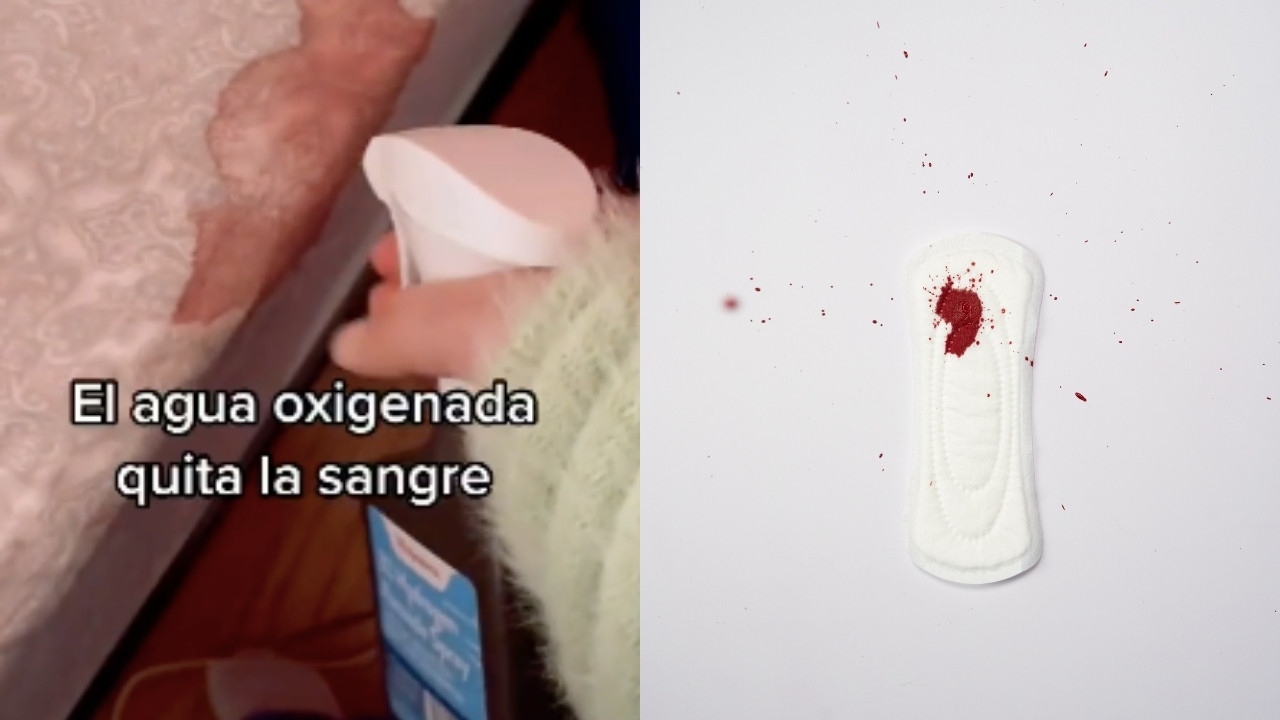 que haces si manche cama de sangre