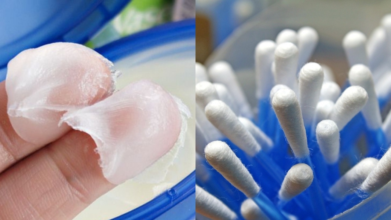 como eliminar puntos negros