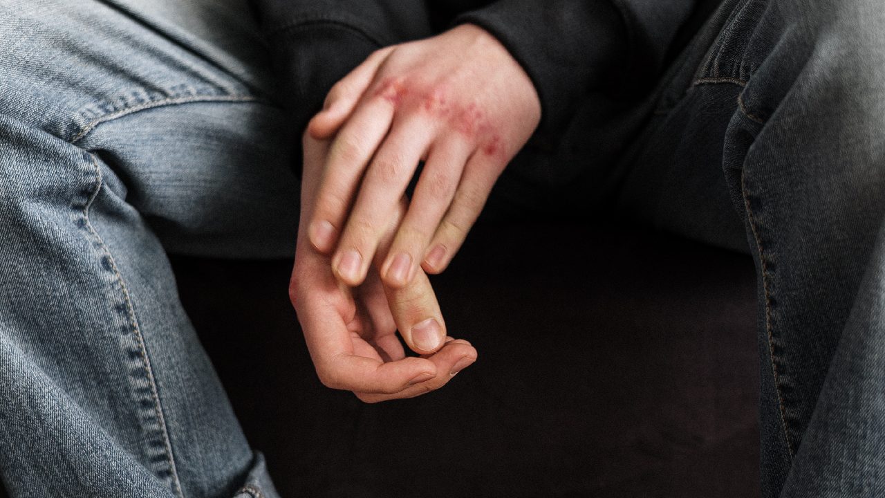 que hacer si tu novio esta en pelea