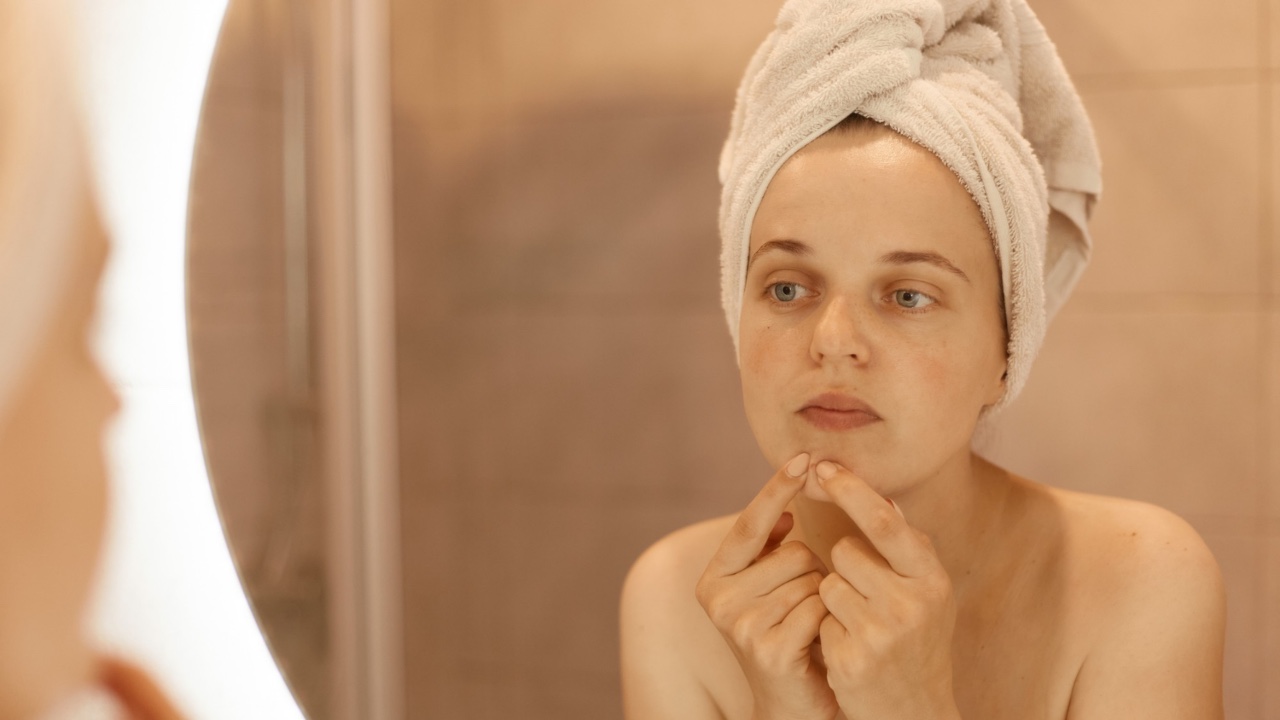 rosacea en la cara tratamiento cura