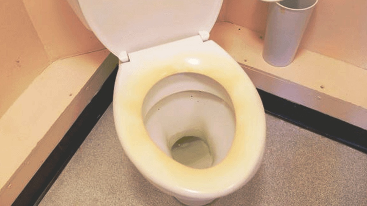 quitar manchas amarillas del asiento y tapa del inodoro 1
