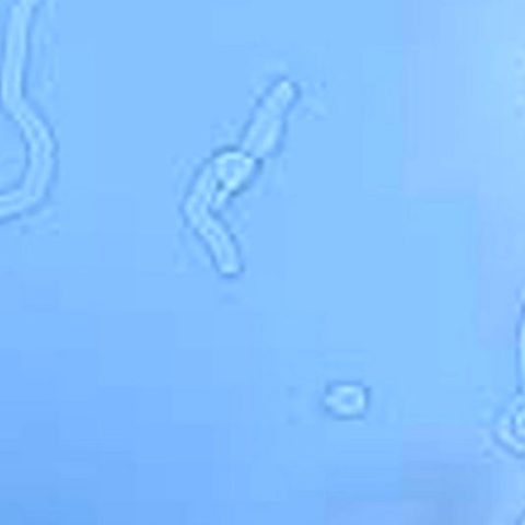 luces o gusanos que se ven