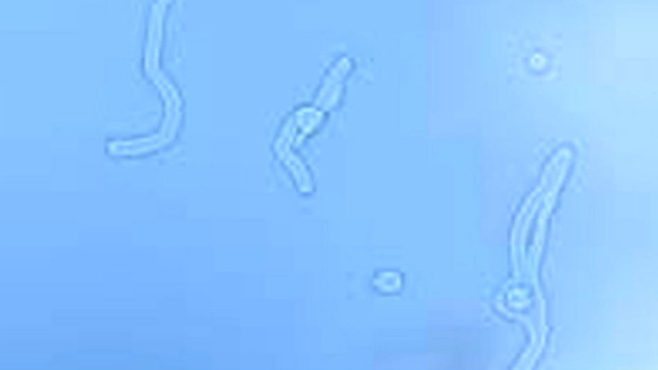 luces o gusanos que se ven