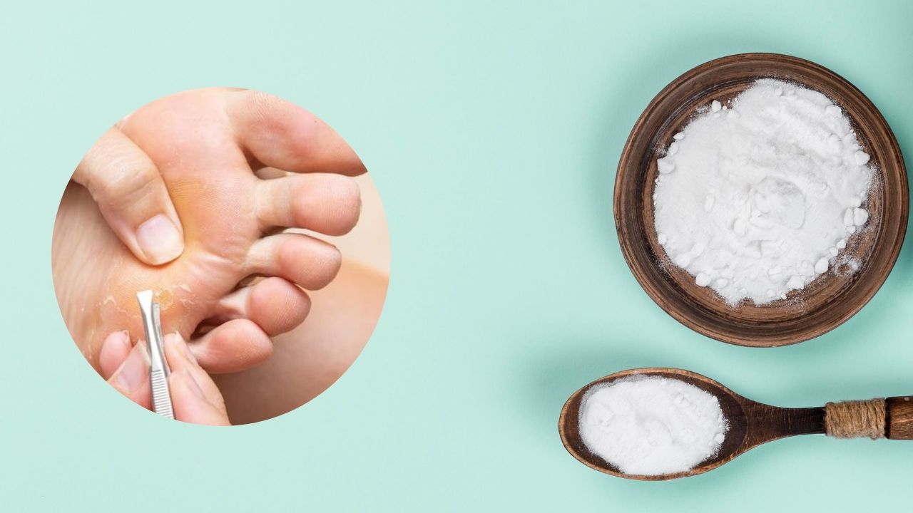 como eliminar callos en pies