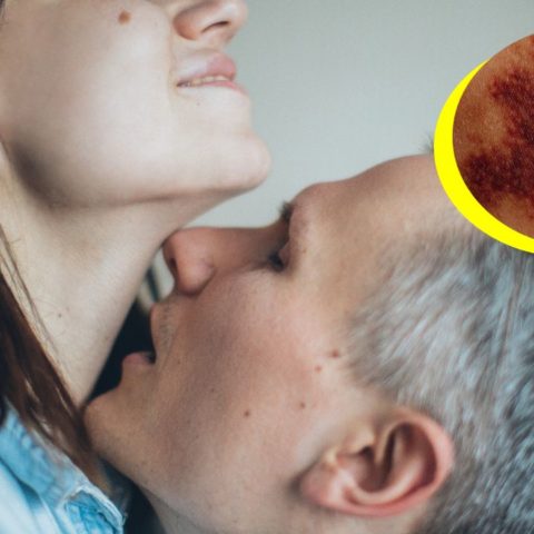 Los chupetones podrían ser mortales