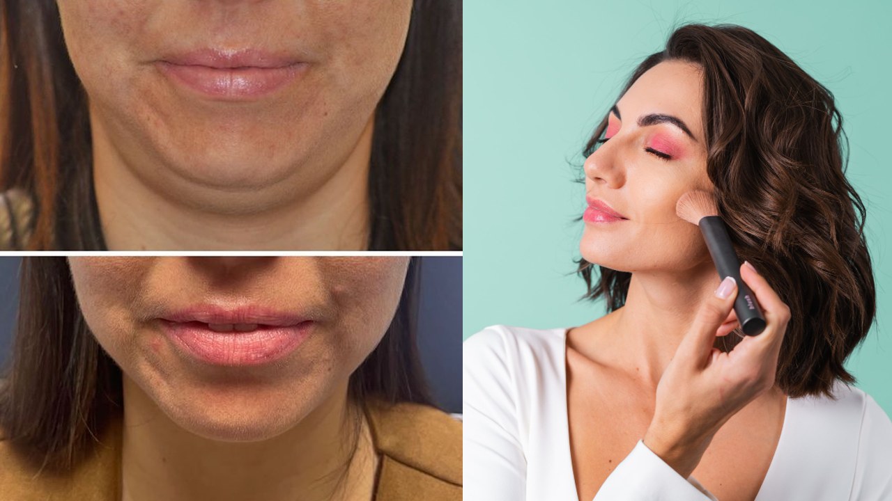 como eliminar la papada rapido