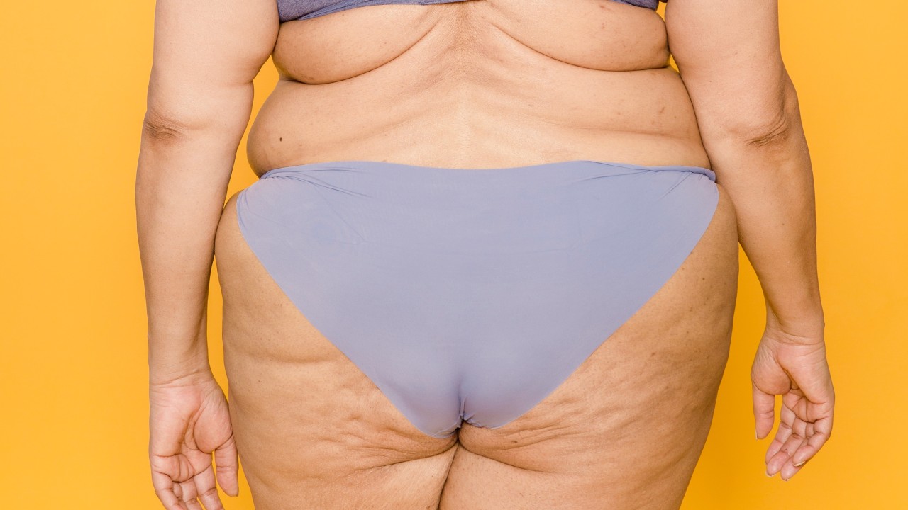 Combate la celulitis con hueso de aguacate