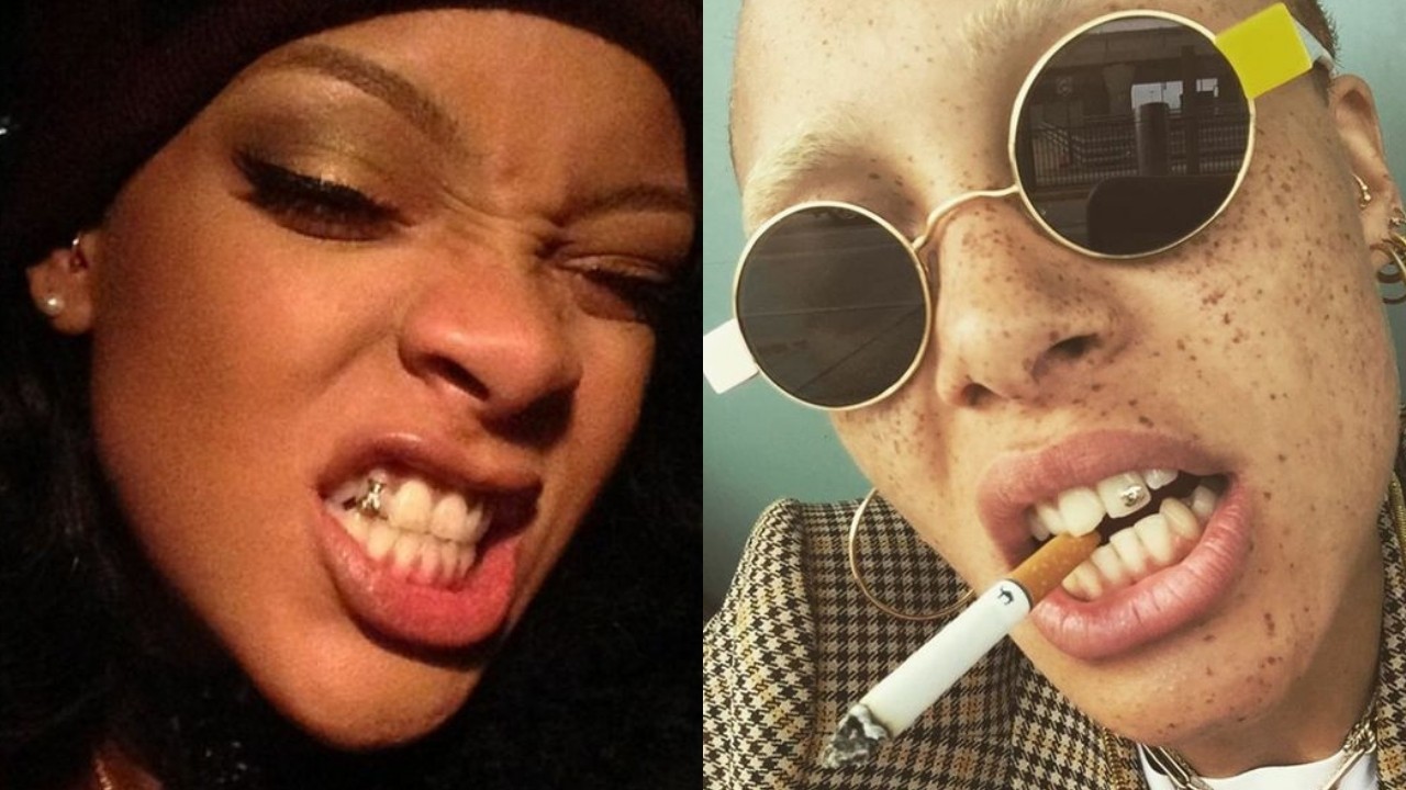 diamantes en dientes peligros