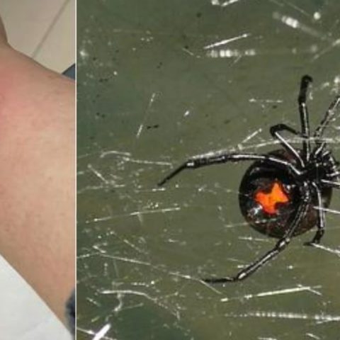 Esto pasa con la picadura de viuda negra común en la CDMX