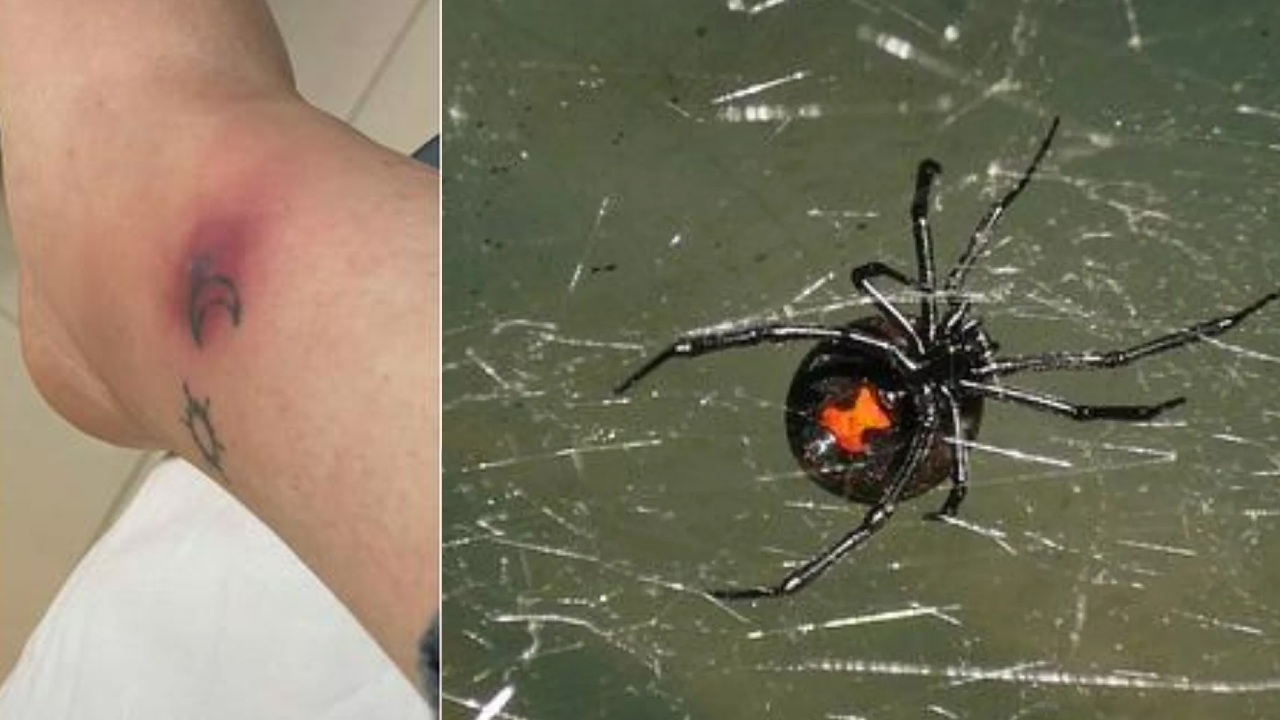 Esto pasa con la picadura de viuda negra común en la CDMX