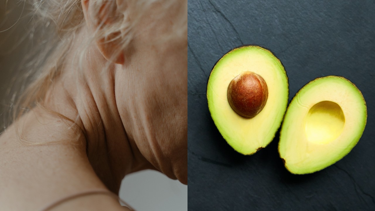 aguacate para reducir arrugas del cuello