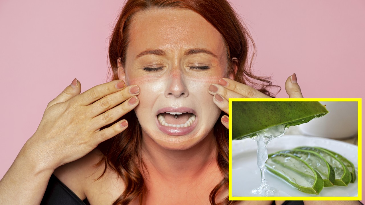 sábila para quemaduras solares