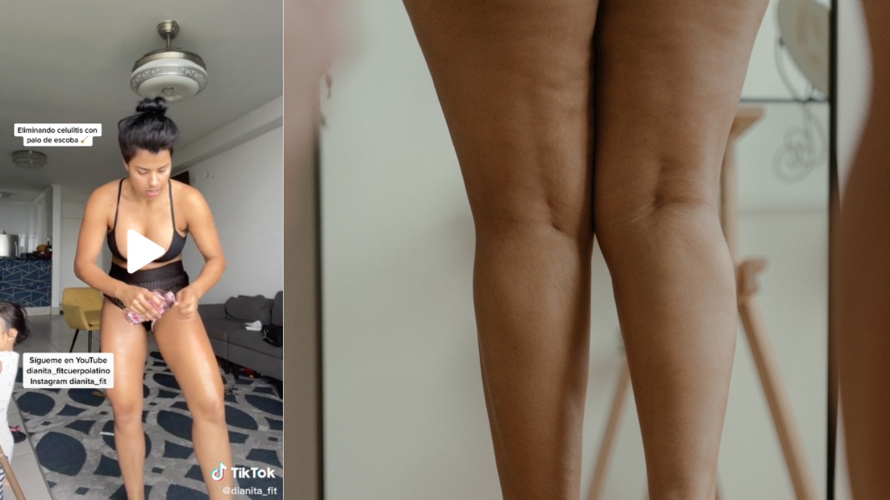 drenaje linfatico eliminar celulitis
