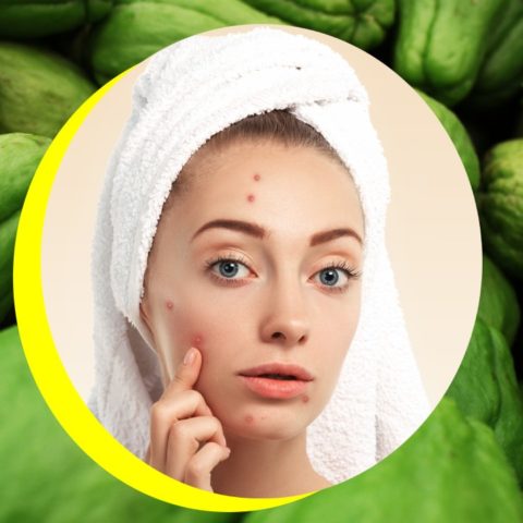 Chayote para eliminarel acné