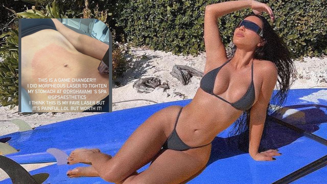 abdomen kim kardashian